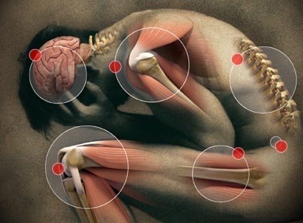 MSK Pain